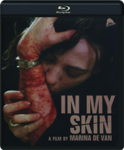 IN MY SKIN