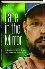 FACE IN THE MIRROR: A Surgeon, a Patient, and the Remarkable Story of the First Face Transplant at Mayo Clinic
