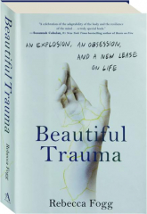 BEAUTIFUL TRAUMA: An Explosion, an Obsession, and a New Lease on Life