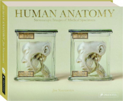 HUMAN ANATOMY: Stereoscopic Images of Medical Specimens