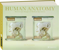 HUMAN ANATOMY: Stereoscopic Images of Medical Specimens