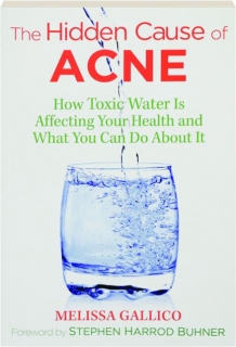 THE HIDDEN CAUSE OF ACNE: How Toxic Water Is Affecting Your Health and What You Can Do About It