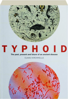 TYPHOID: The Past, Present and Future of an Ancient Disease