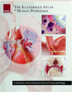 THE ILLUSTRATED ATLAS OF HUMAN PATHOLOGY